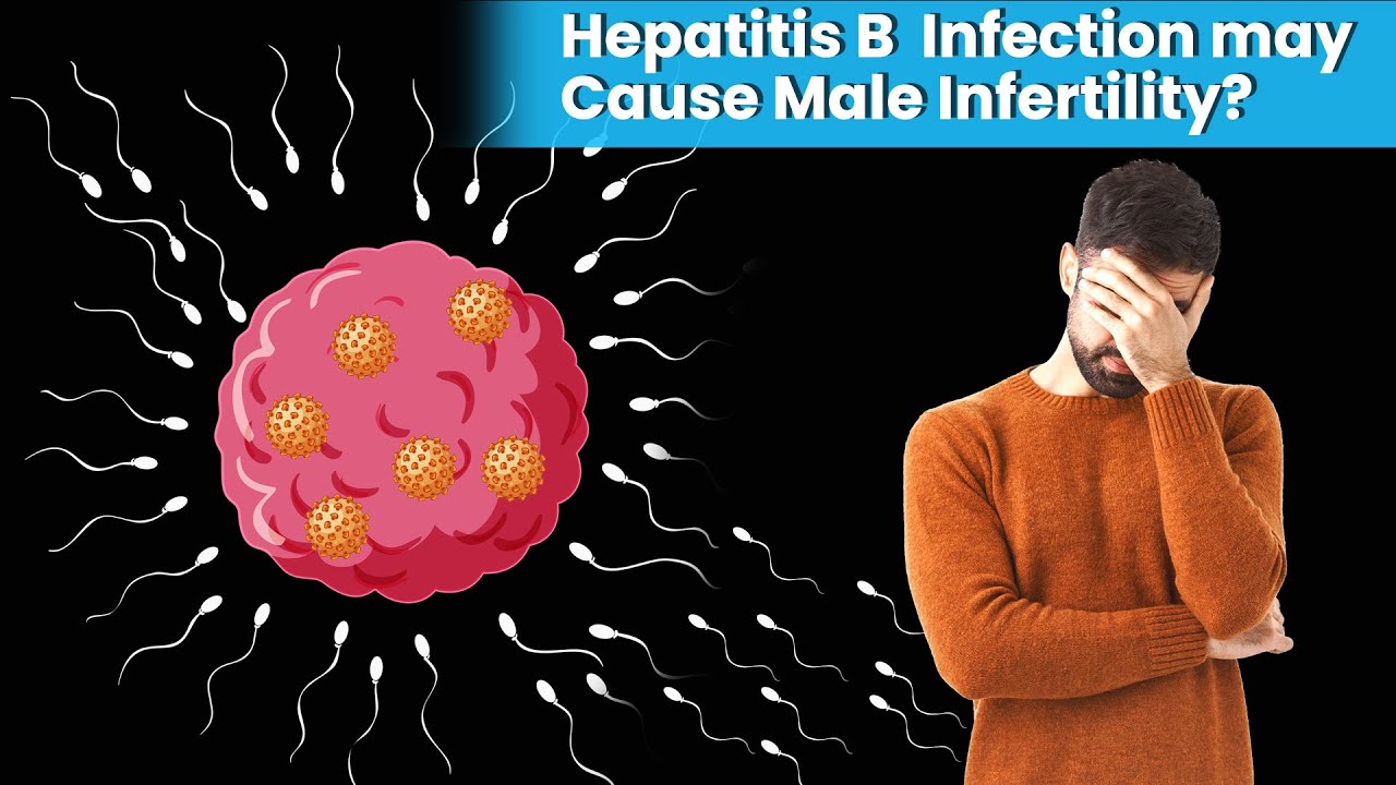 Can Viral Hepatitis Affect Male Fertility?