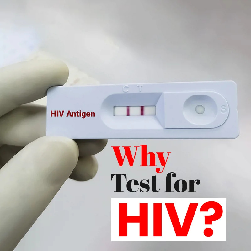 HIV/AIDS: Causes of Infection and Prevention