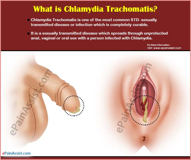 क्लैमाइडिया (Chlamydia) संक्रमण की पहचान